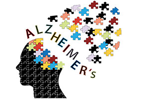 预防阿尔茨海默症