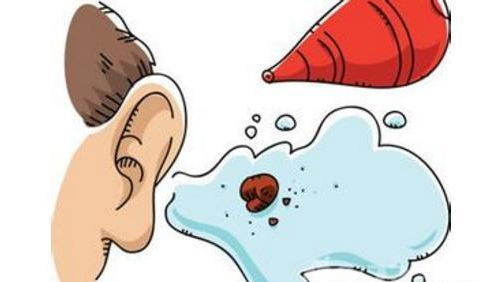 如何预防外耳炎疾病发生？